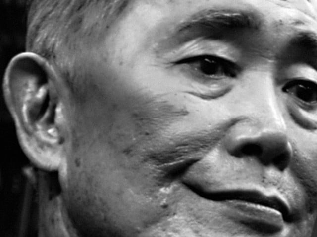 Takei or not Takei &#151; ?when our own offend